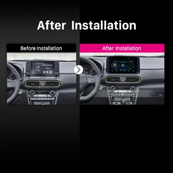 Seicane Android 10.0 HD Touchscreen Auto Multimediju Atskaņotājs, GPS 2018 2019 Hyundai ENCINO Kona ar Bluetooth atbalstu Carplay